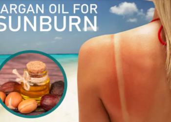 Sunburn during pregnancy