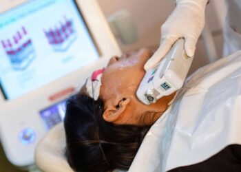 The Best Method of Hair Removal